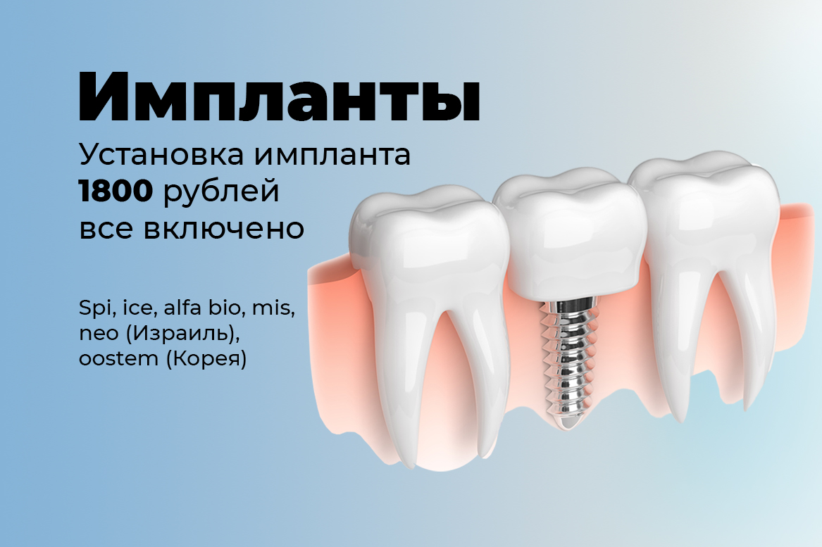 Импланты в воронеже. Импланты Alpha Bio. Израильские импланты. Рекламный баннер импланты.